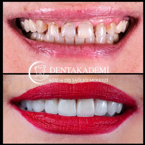 Before after photos of our patients 3